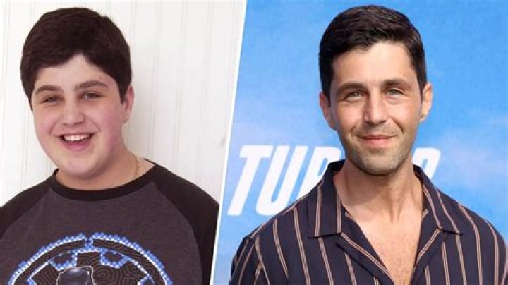 Josh Peck Plastic Surgery: Know All About His Before and After Plastic Surgery - SarkariResult